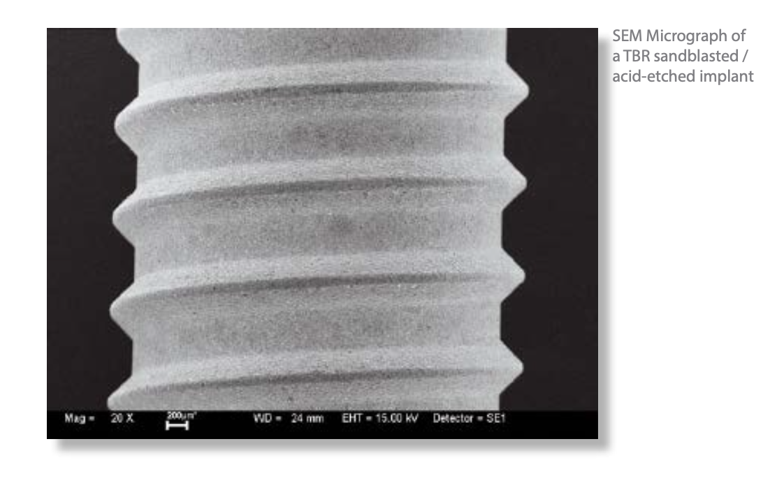 SEM-micrograaf van een TBR sandblasted / acid-etched implantaatoppervlak