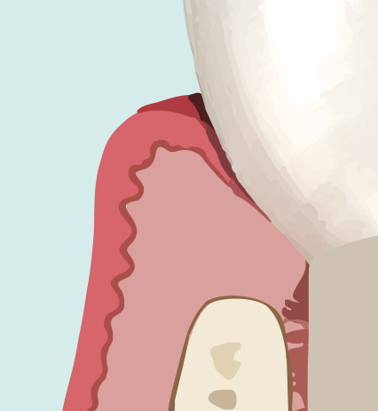 Natuurlijke tand — anatomische referentie