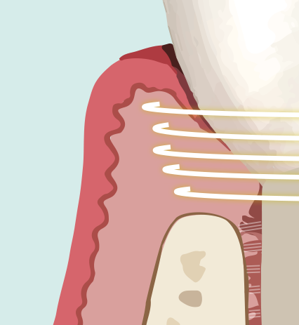 Natuurlijke tand — anatomische referentie