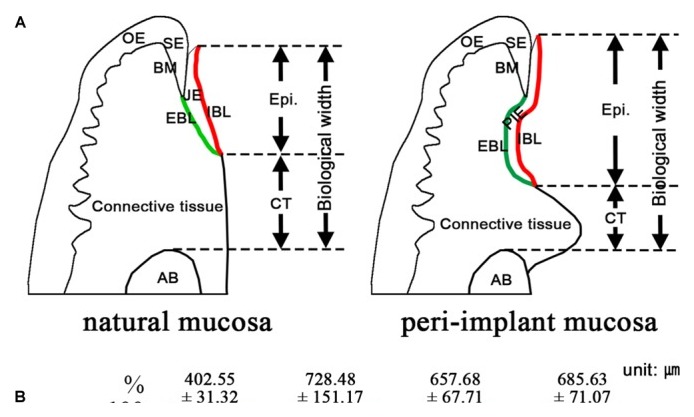Originele wetenschappelijke schematische vergelijking van natuurlijke mucosa en peri-implantaire mucosa met epitheel, bindweefsel en biologische breedte